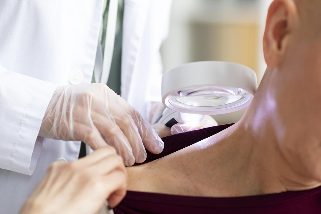 Doctor piel tratamiento revisión chequeo dermatologo psoriasis cancer