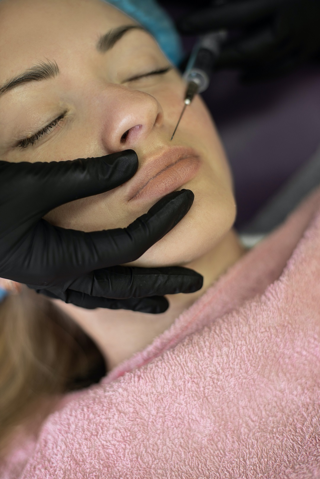 Mujer recibiendo inyección en la cara botox neurotoxina tratamiento