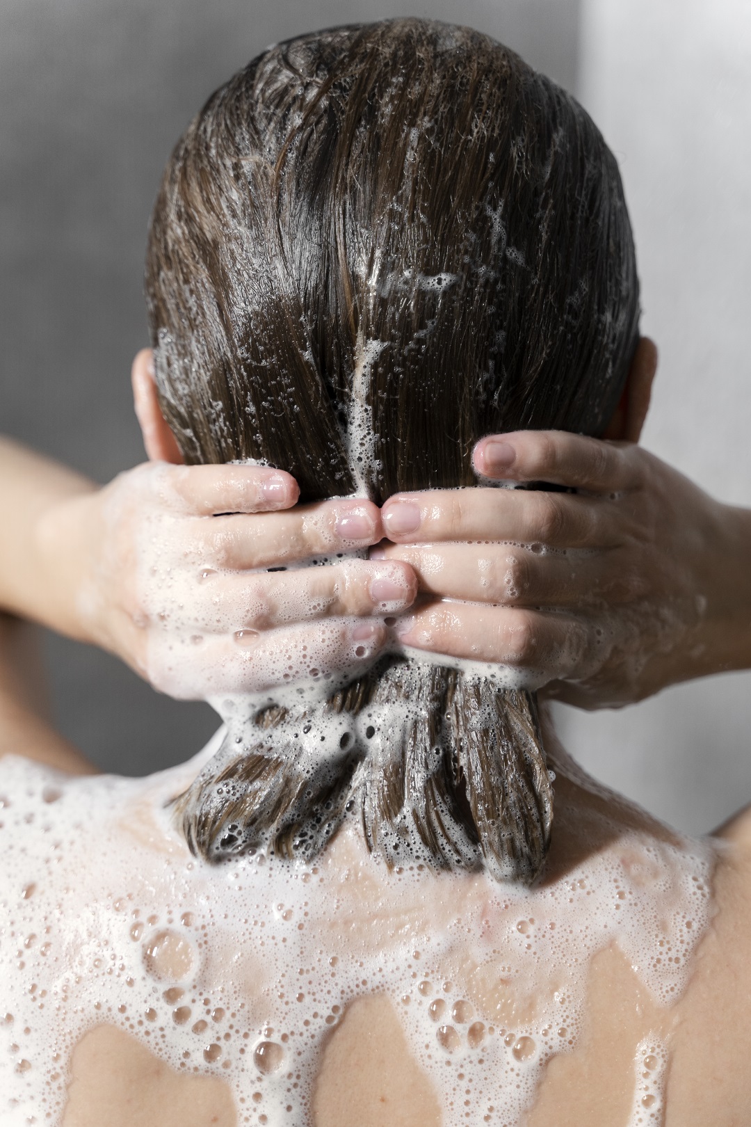mujer joven que aplica shampoo producto anticaspa lavado cabello pelo