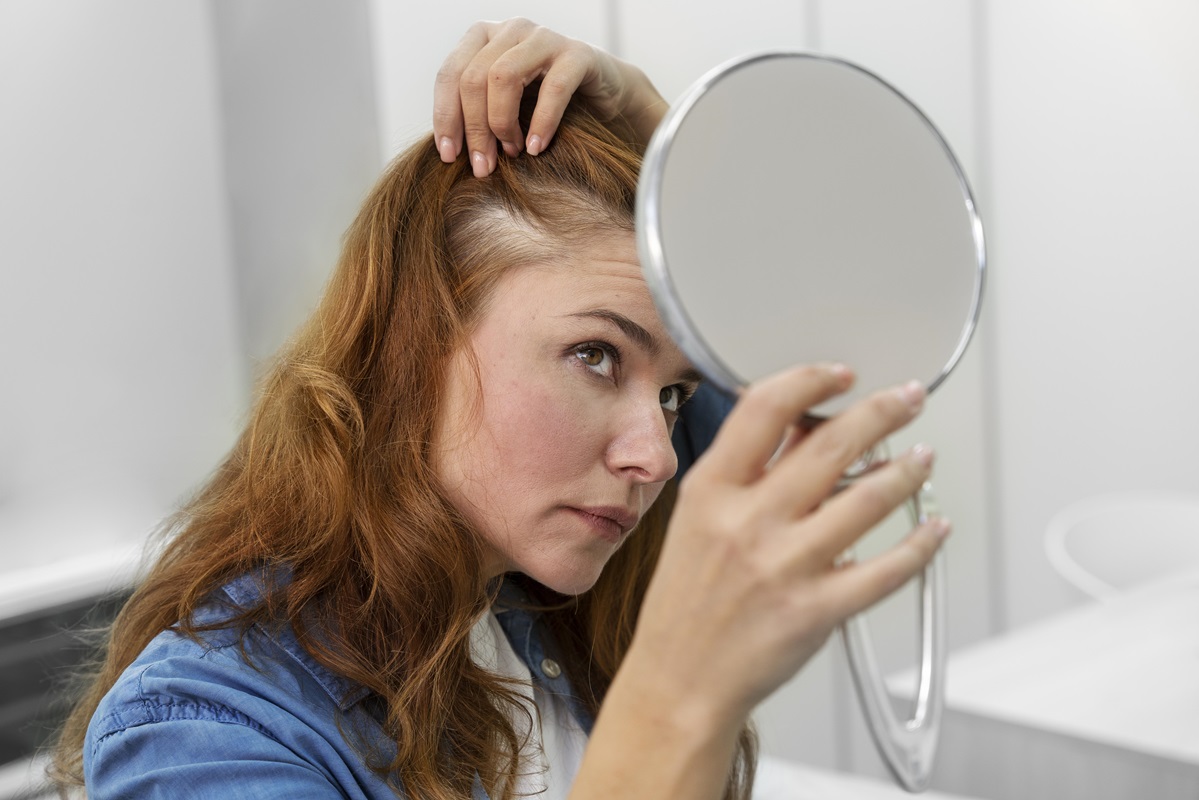 Caída perdida cabello pelo alopecia calvicie calvo